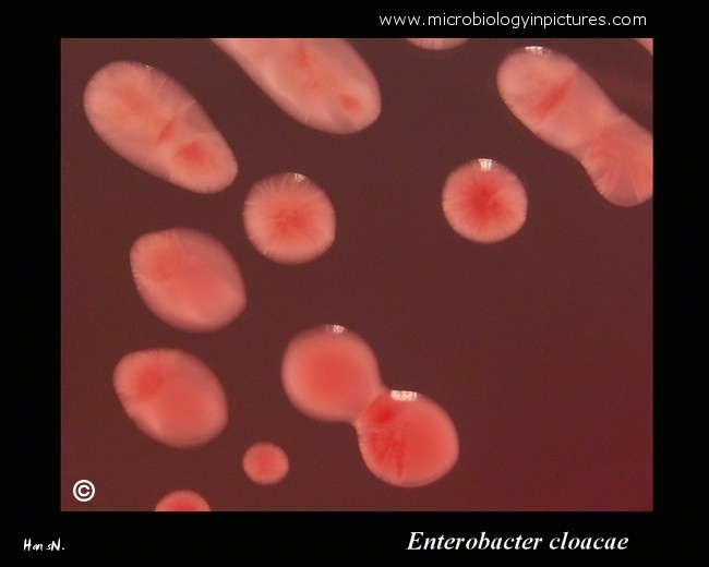 enterobacter cloacae 04